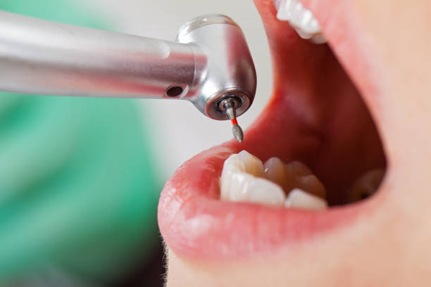 Best Pediatric Emergency Dentist in Rochester Institute Of Technology, NY